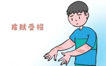 ϾƤомô