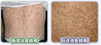 ���۲�����ж����س̶�