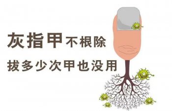 �Ͼ��������λ�ָ�׵�