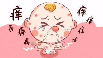 湿疹患者可以吃鸡蛋吗